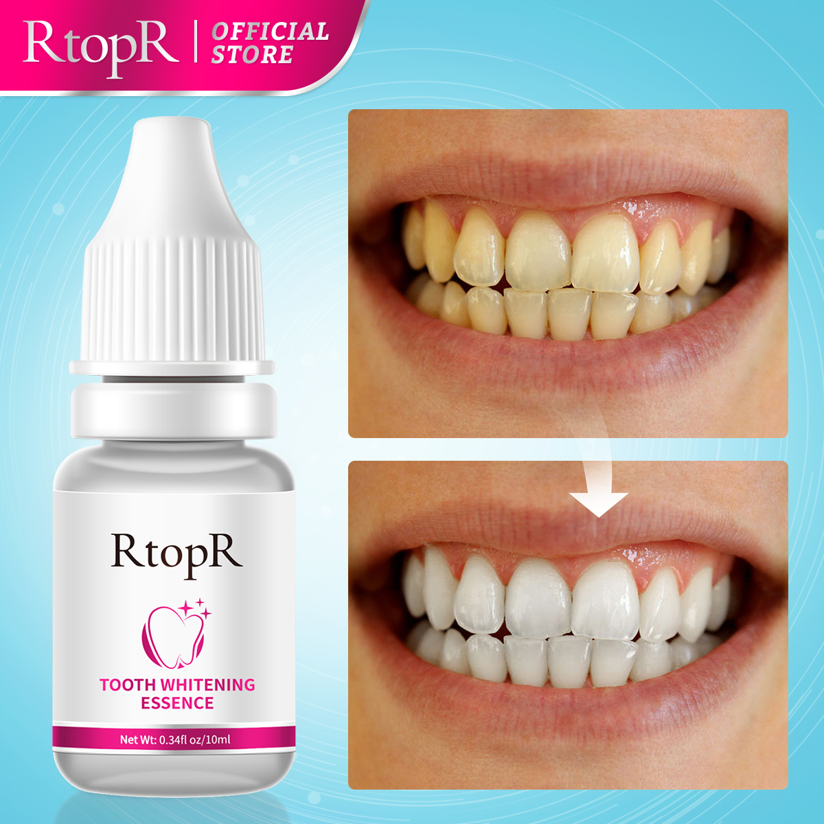 Teeth Whitening Xylitol - Tooth Whitening Serum Whitening Teeth Removing