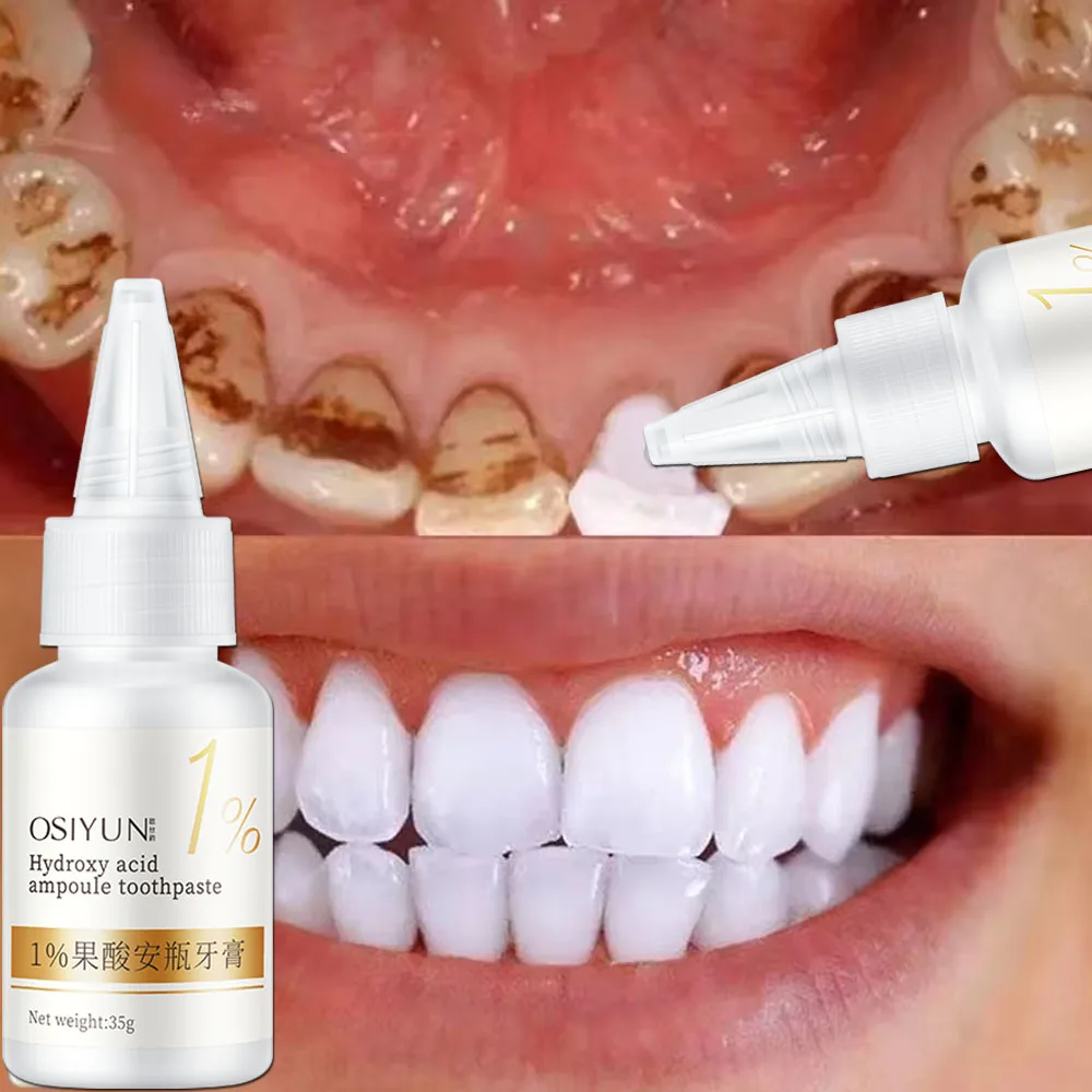 Teeth Whitening Xylitol - Teeth Whitening Toothpaste Fruit Acid Remove