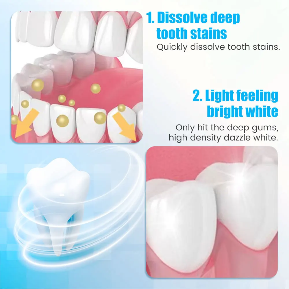 9D Teeth Whitening Stickers Mi - Teeth Whitening Yellow Teeth ulasan dan harga