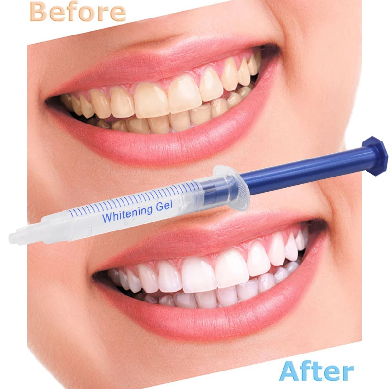 20 pcs Teeth Whitening gels De - Teeth Whitening Essence ulasan dan harga