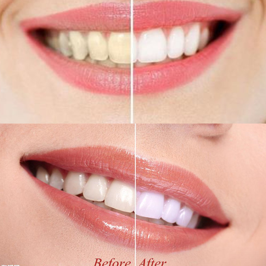 Bamboo Charcoal Teeth Tooth De - Teeth Whitening Essence ulasan dan harga