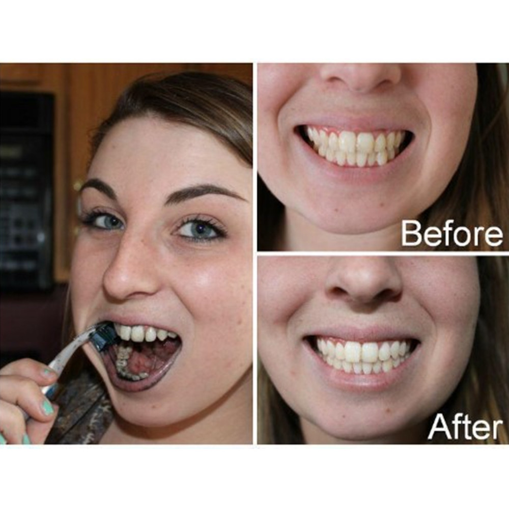 Bamboo Charcoal Teeth Tooth De - Teeth Whitening Essence ulasan dan harga