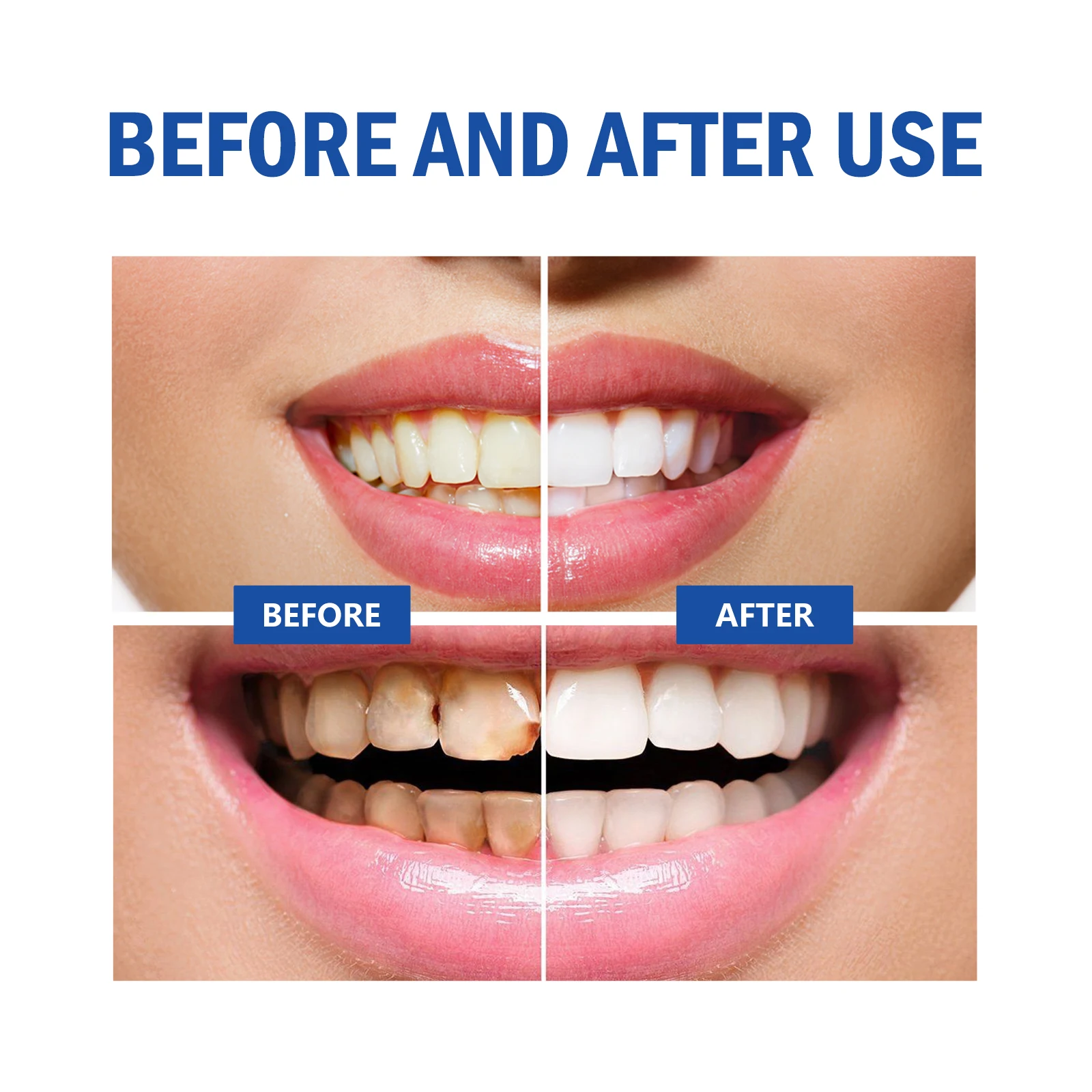 2pcs Gum Repair Gel Spray Deep - Teeth Whitening Xylitol ulasan dan harga