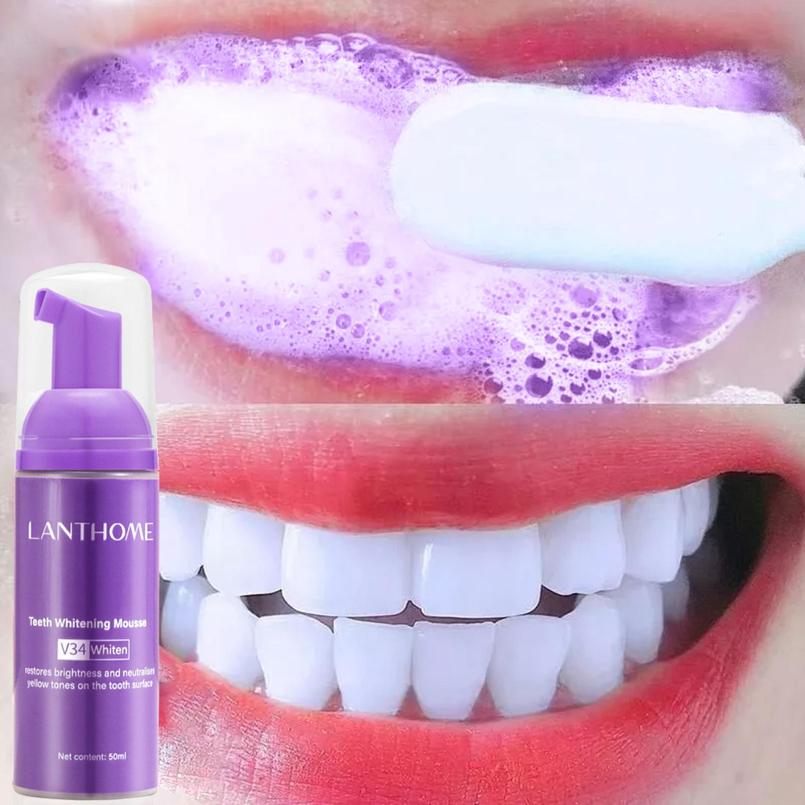 V34 Mousse Teeth Cleaning Toot - Teeth Whitening Yellow Teeth ulasan dan harga