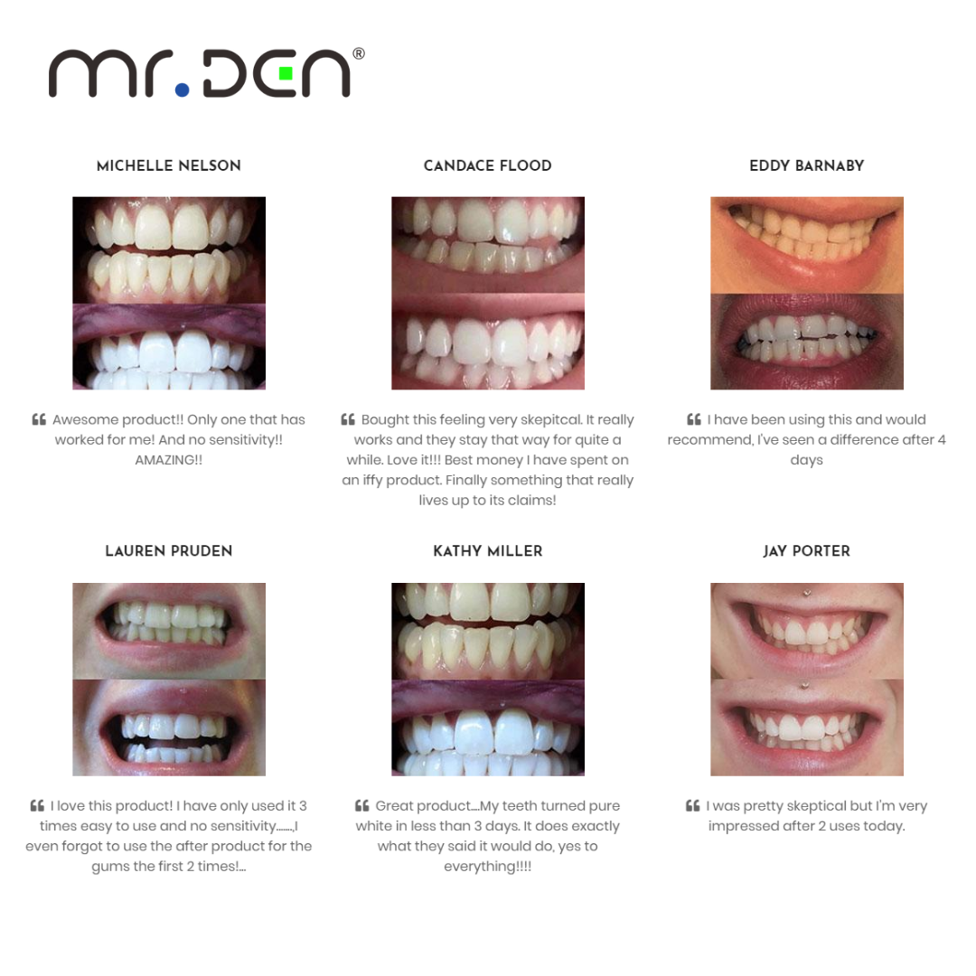 Dr. Whiten 3 Pack Teeth Whiten - Teeth Whitening Gum ulasan dan harga