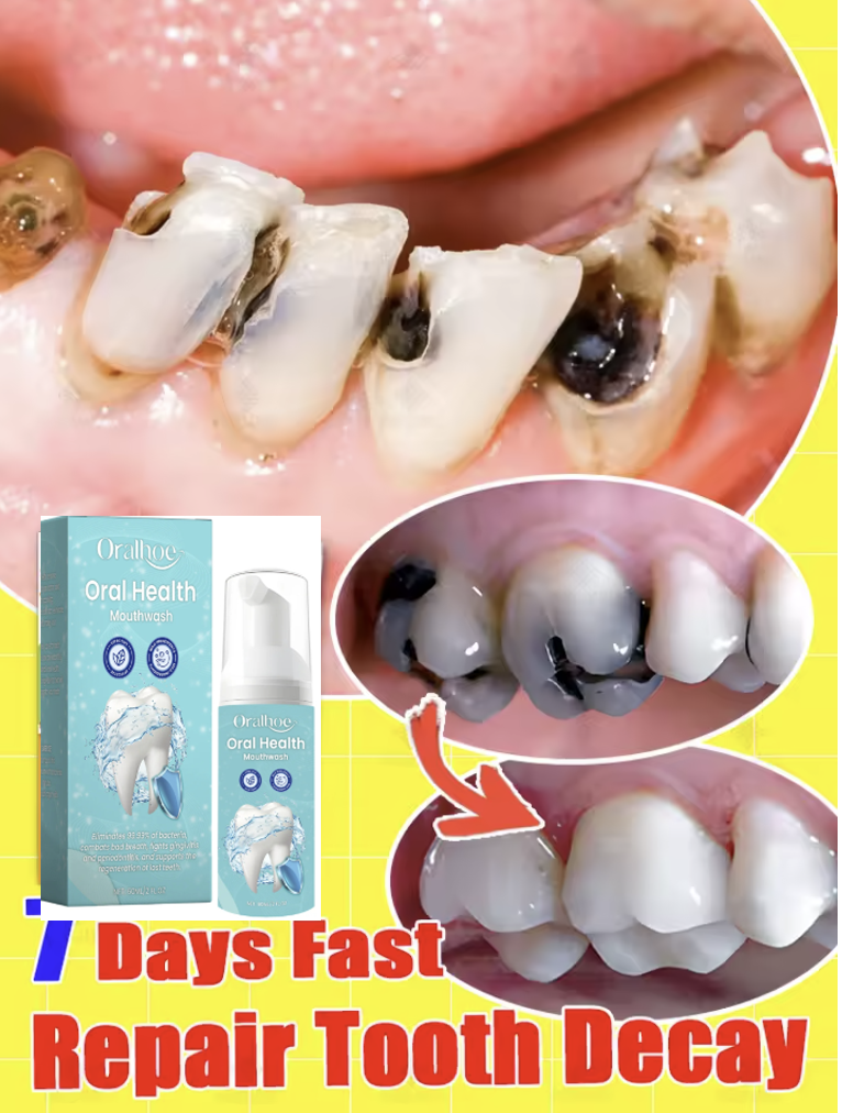 Oralhoe 60ml Teeth Cleaning Mo - Teeth Whitening Foam Toothpaste ulasan dan harga