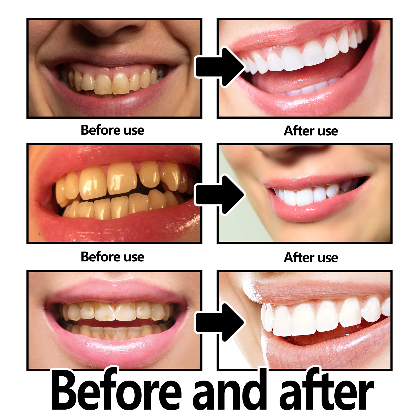 Xylitol Mint Purple Toothpaste - Teeth Whitening Xylitol ulasan dan harga