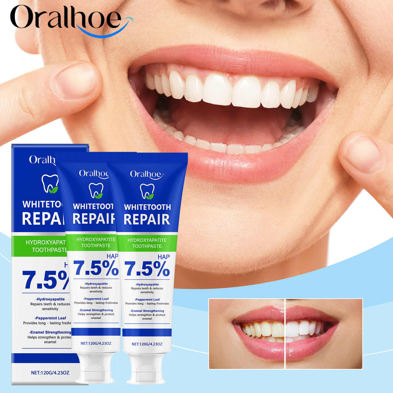 Oralhoe Nicotinamide Whitening - Teeth Whitening Treatment ulasan dan harga
