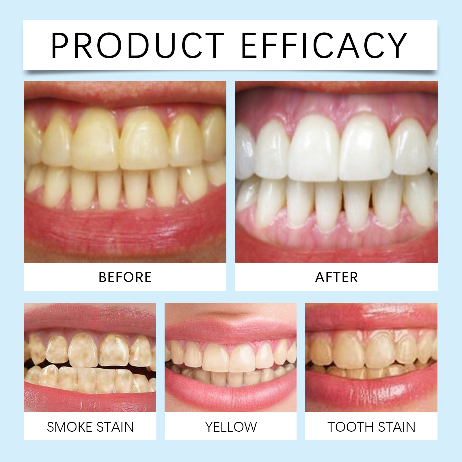 Oralhoe Nicotinamide Whitening - Teeth Whitening Treatment ulasan dan harga
