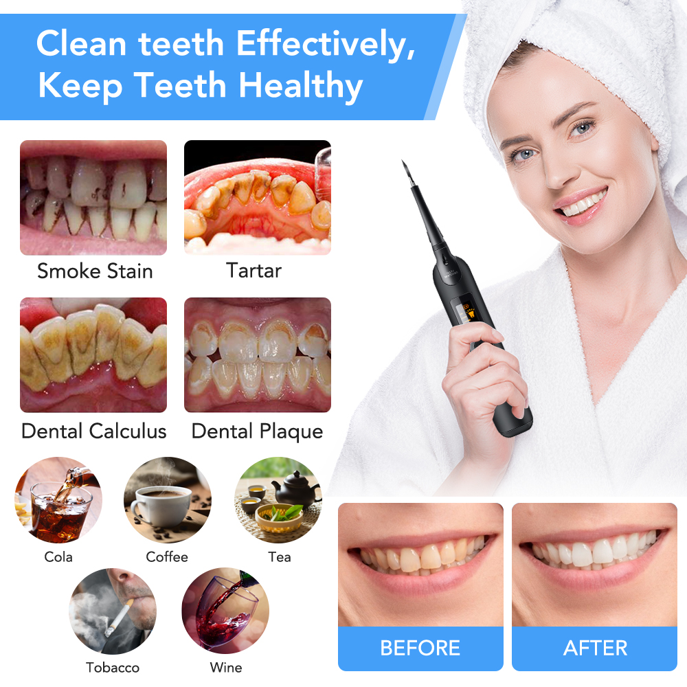Teeth Tartar Remover Electric  - Teeth Whitening Kit At Home ulasan dan harga