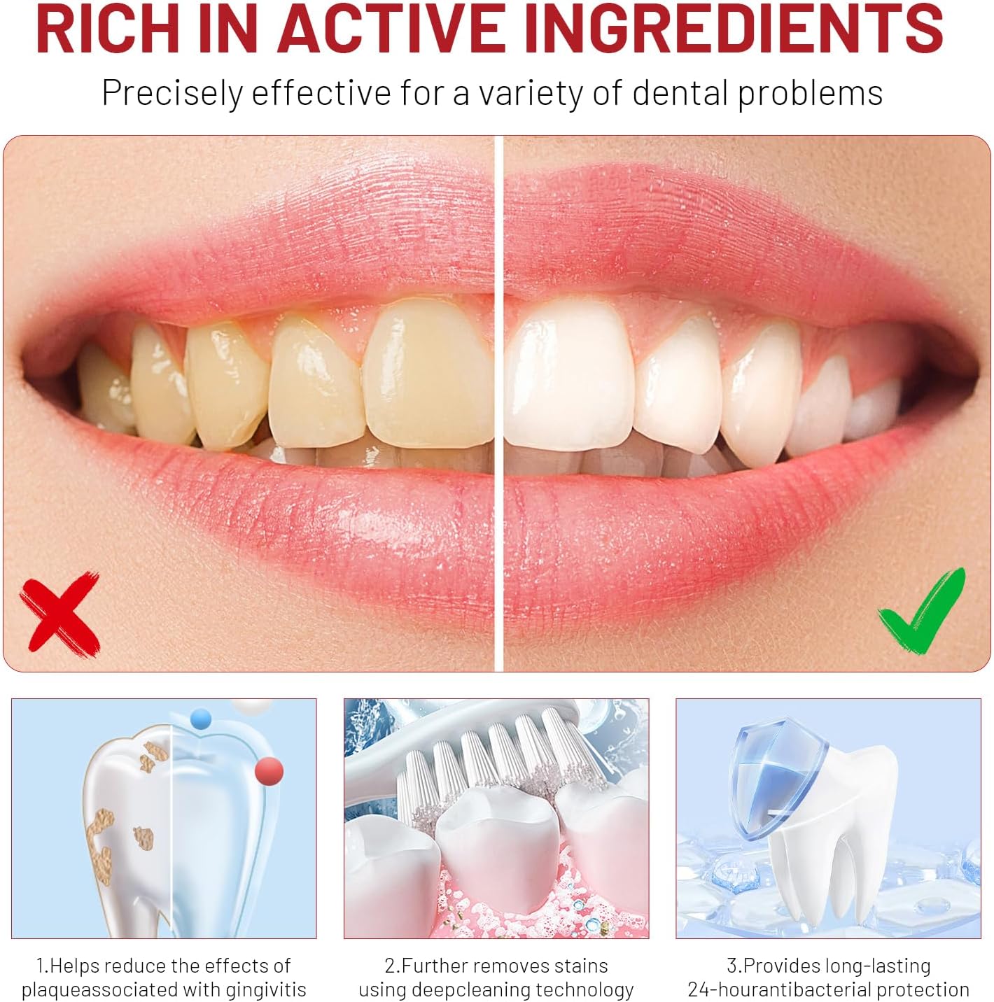 Niacinamide Whitening Toothpas - Teeth Whitening Treatment ulasan dan harga