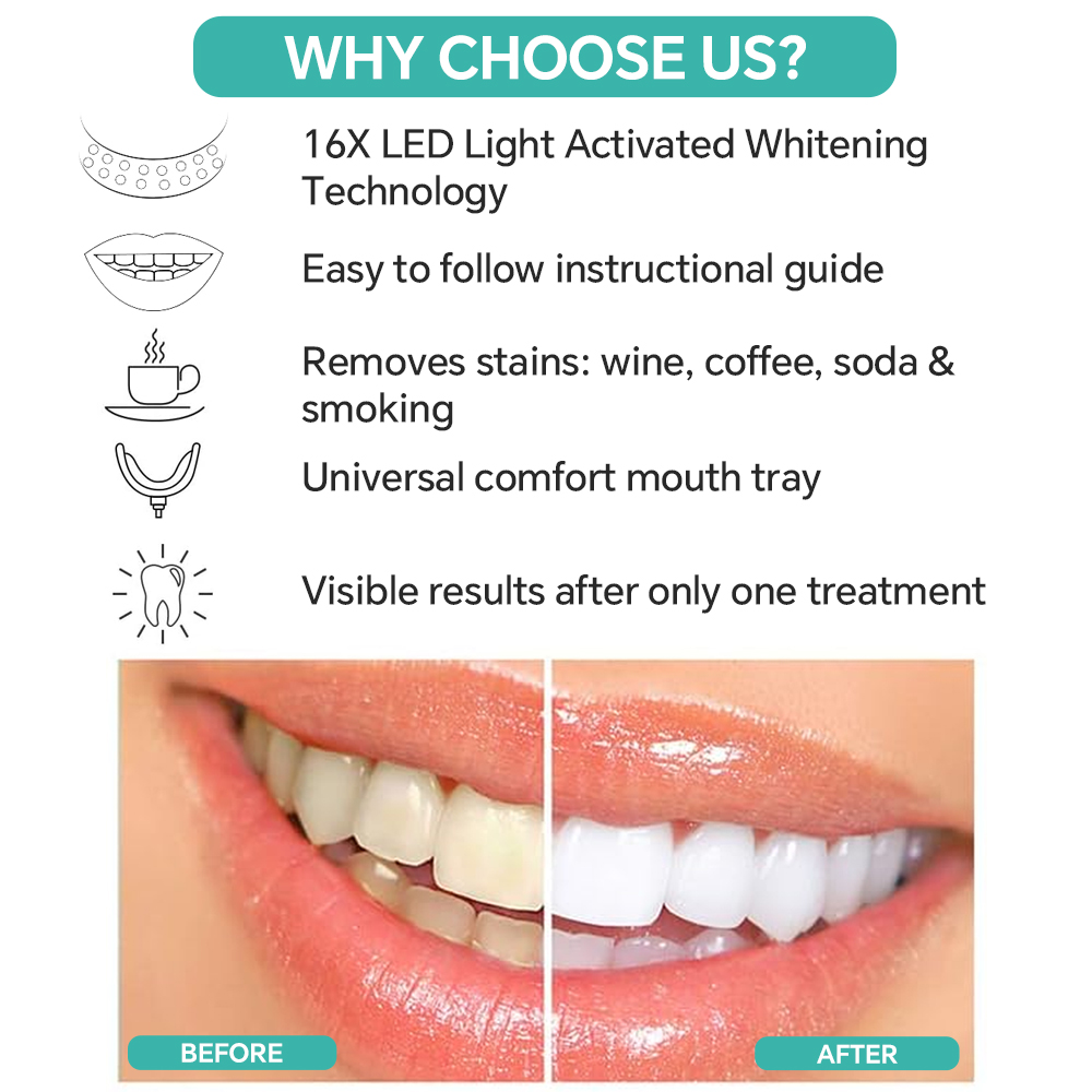 Teeth Whitening Accelerator Li - Teeth Whitening/Bleaching ulasan dan harga
