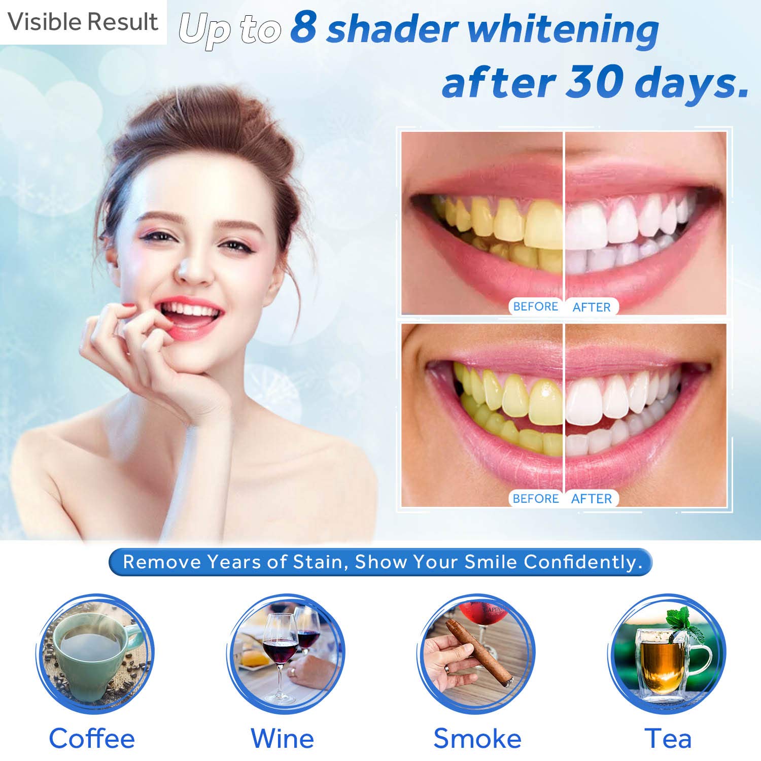 Teeth Whitening Gel Refill Syr - Teeth Whitening Kit At Home ulasan dan harga