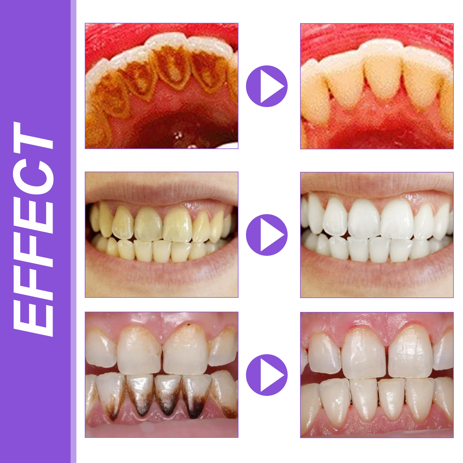 EELHOE Smiles Bright White Ref - Teeth Whitening Xylitol ulasan dan harga