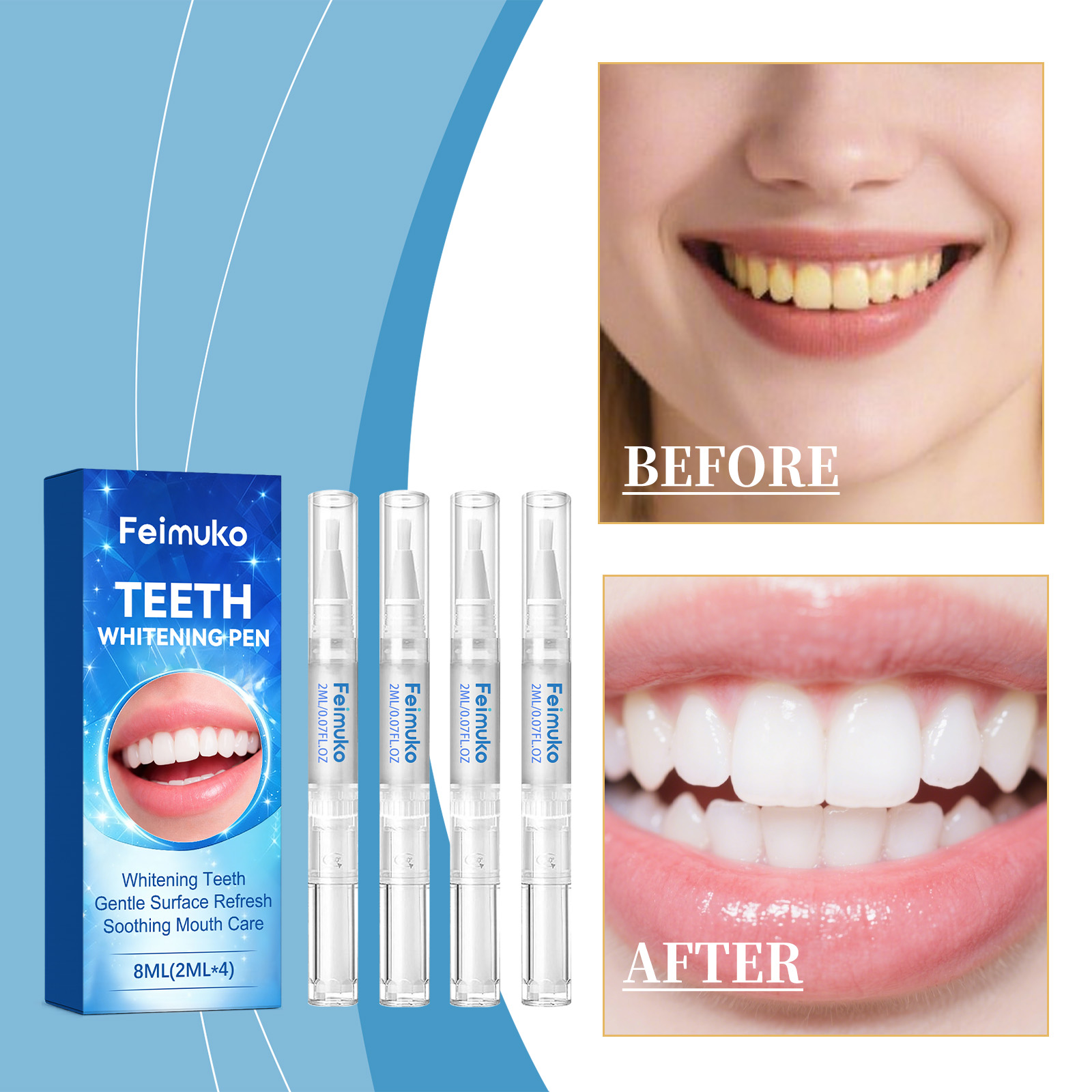 Feimuko 8ml Teeth Gel Pen Gent - Teeth Whitening Essence ulasan dan harga