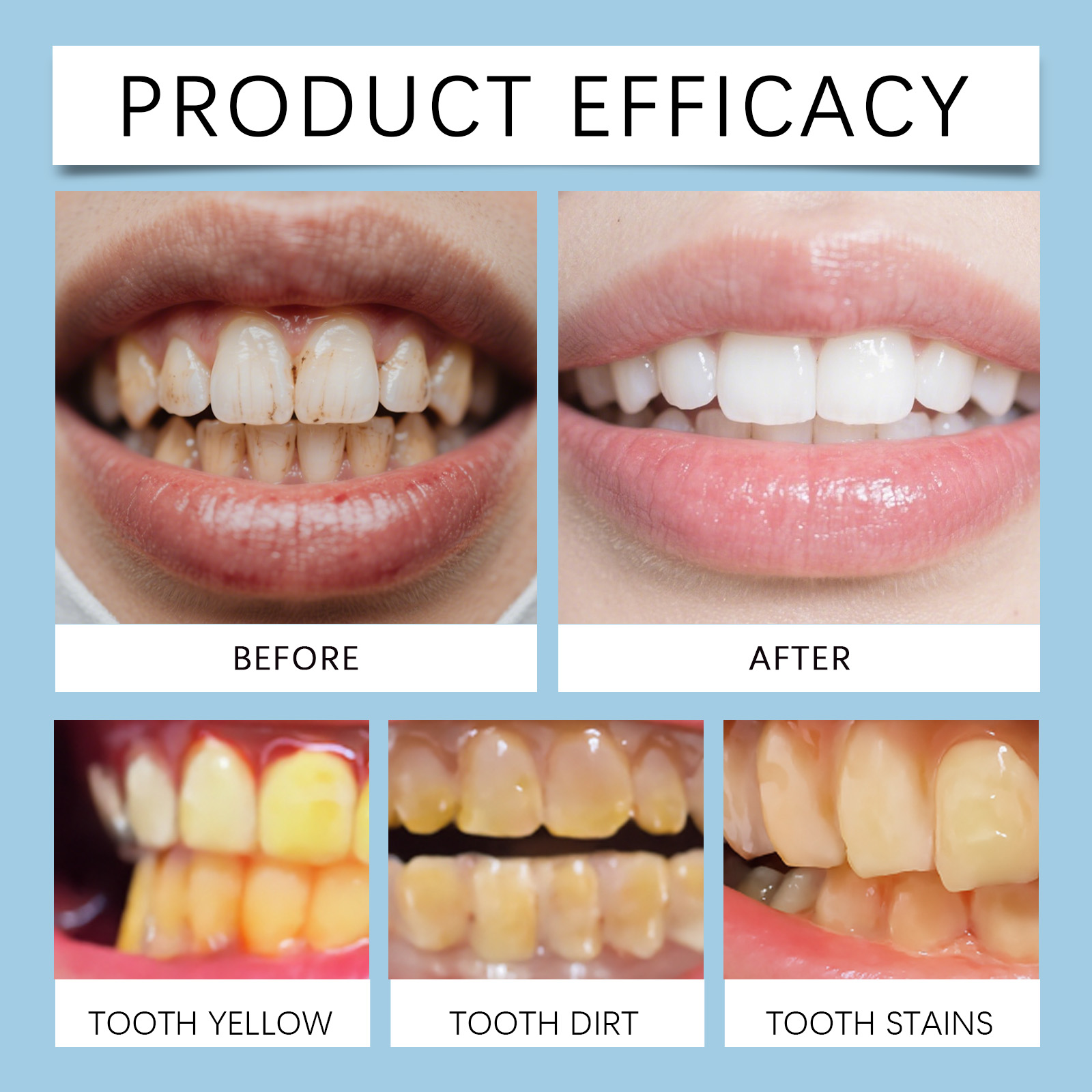 Feimuko 8ml Teeth Gel Pen Gent - Teeth Whitening Essence ulasan dan harga