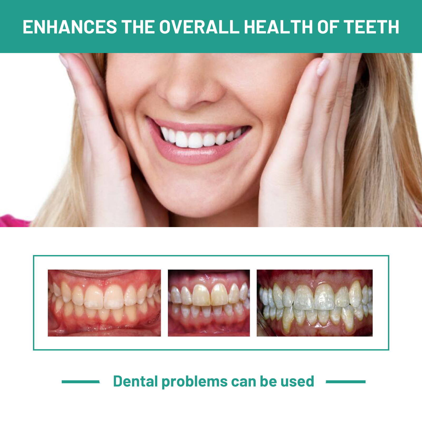 Probiotic Toothpaste Whiten To - Teeth Whitening Xylitol ulasan dan harga
