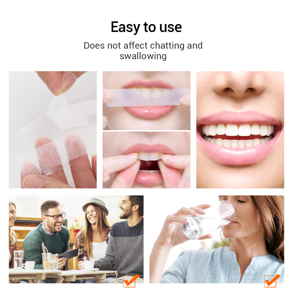 5D Teeth Whitening Strips Remo - Teeth Whitening Yellow Teeth ulasan dan harga