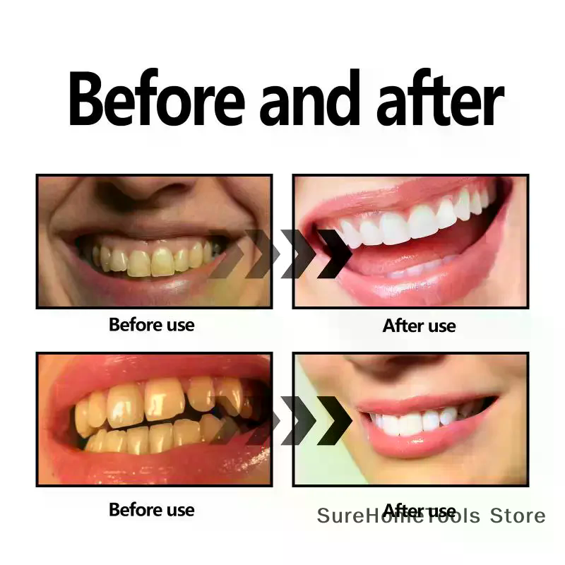 Bamboo Charcoal Powder For Tee - Teeth Whitening Essence ulasan dan harga