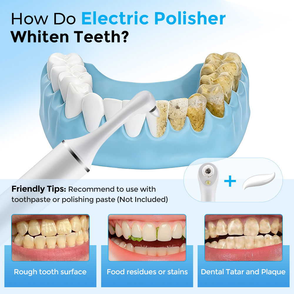 Electric Tooth Polisher Teeth  - Teeth Whitening Led Light ulasan dan harga