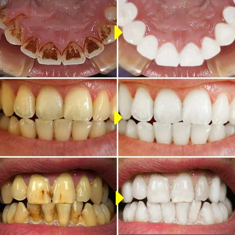 Teeth Whitening Toothpaste Fru - Teeth Whitening Xylitol ulasan dan harga
