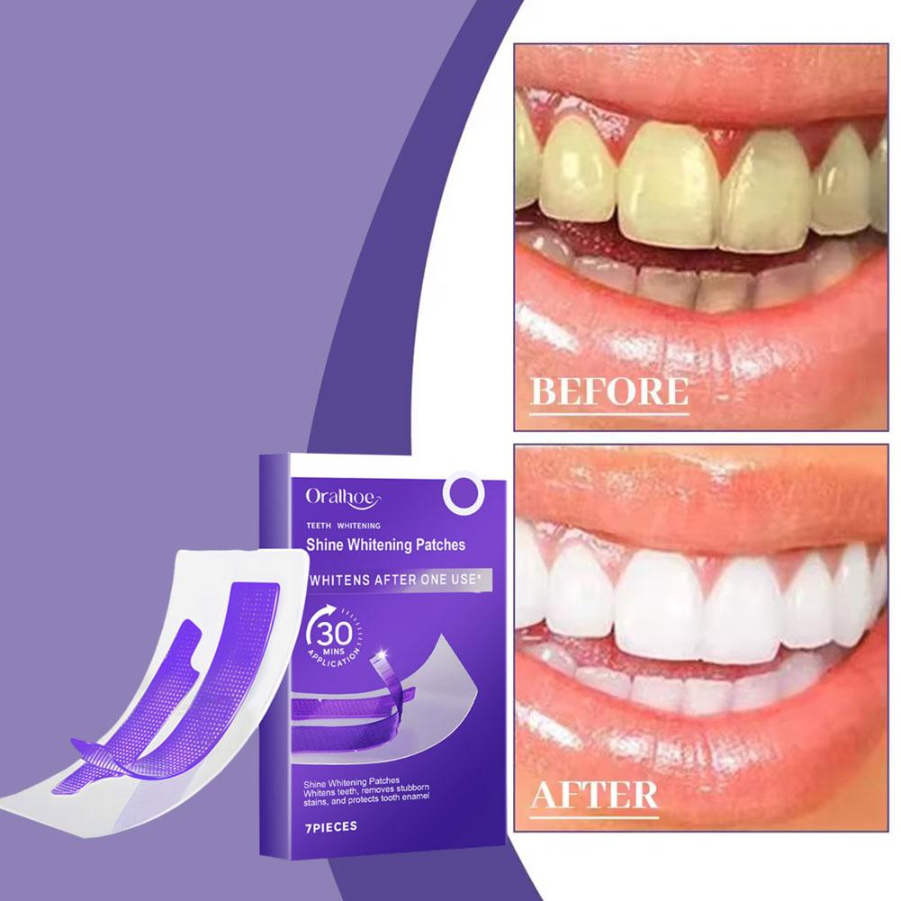 Purple Teeth Whitening Strips  - Teeth Whitening/Bleaching ulasan dan harga