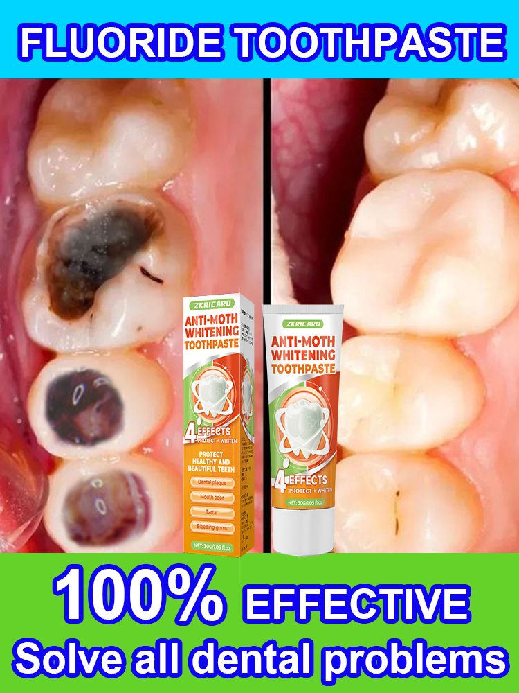 Repair tooth decay and whiten  - Teeth Whitening Treatment ulasan dan harga