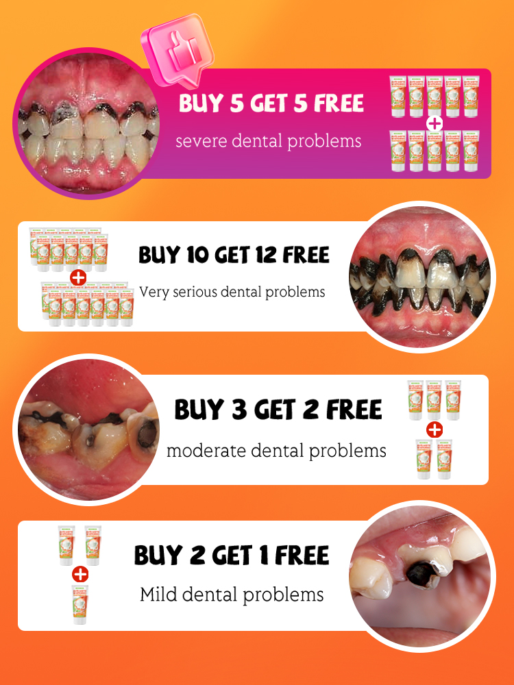 Repair tooth decay and whiten  - Teeth Whitening Treatment ulasan dan harga