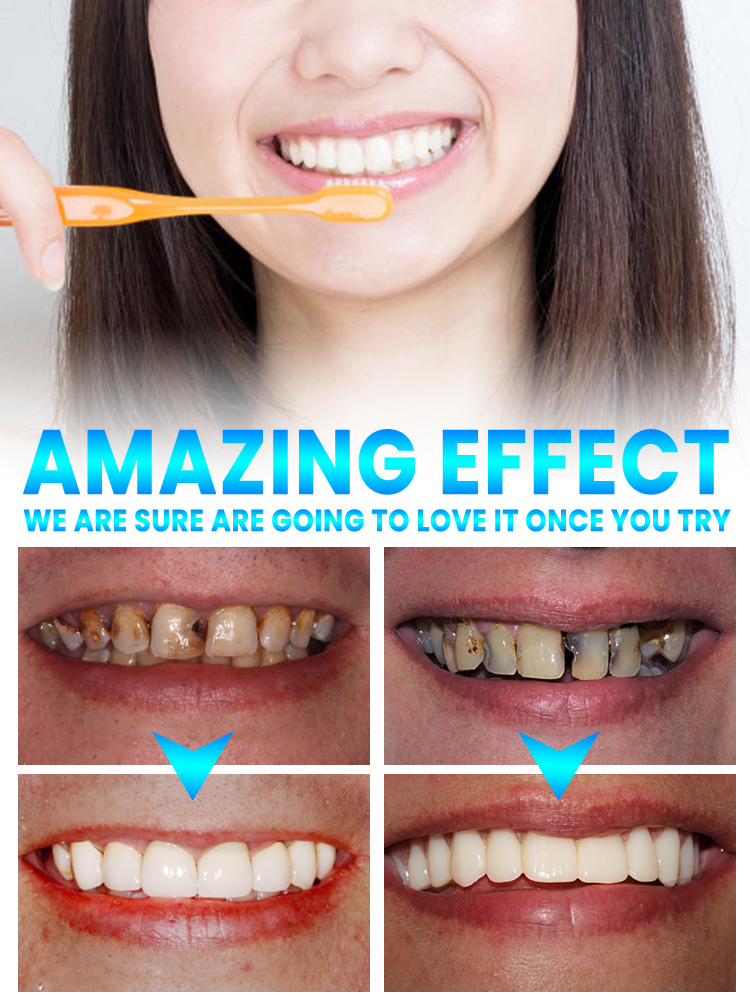 Repair tooth decay and whiten  - Teeth Whitening Treatment ulasan dan harga