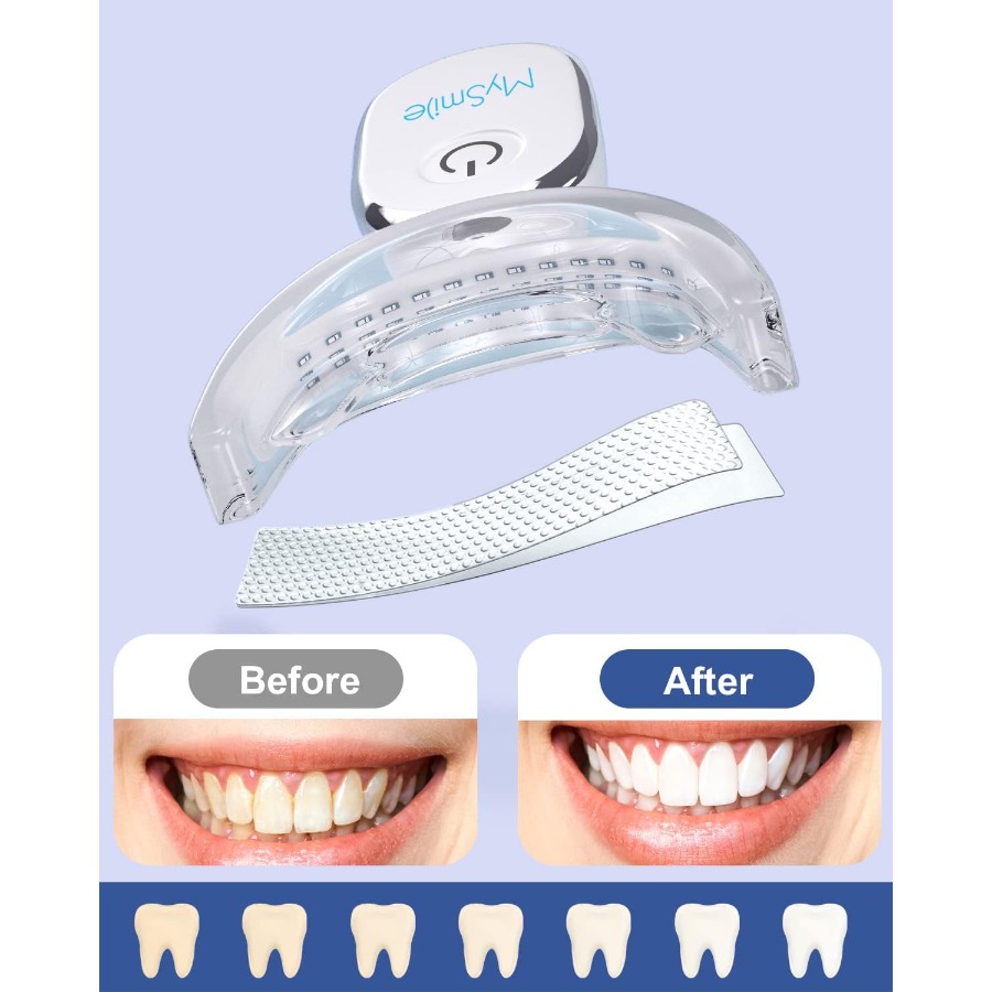Teeth Whitening Strips Kit wit - Teeth Whitening Treatment ulasan dan harga