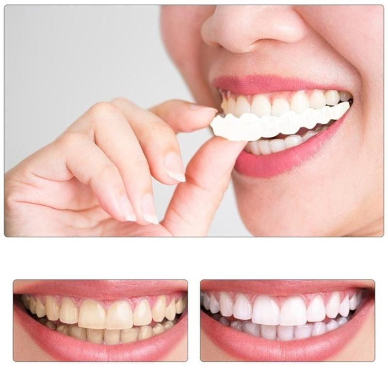 Discolored Teeth Whitening Tee - Teeth Whitening Yellow Teeth ulasan dan harga