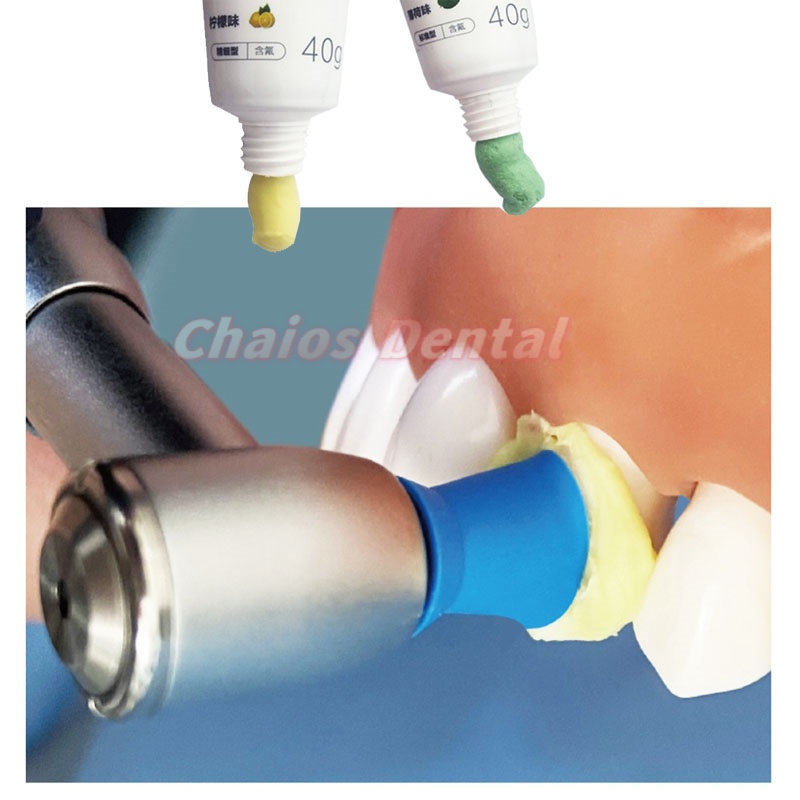 40g/Tube Dental Prophy Paste R - Teeth Whitening Youtube ulasan dan harga