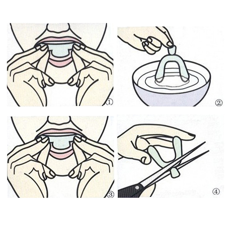 10Pcs Transparent Night Guard  - Teeth Whitening Trays ulasan dan harga