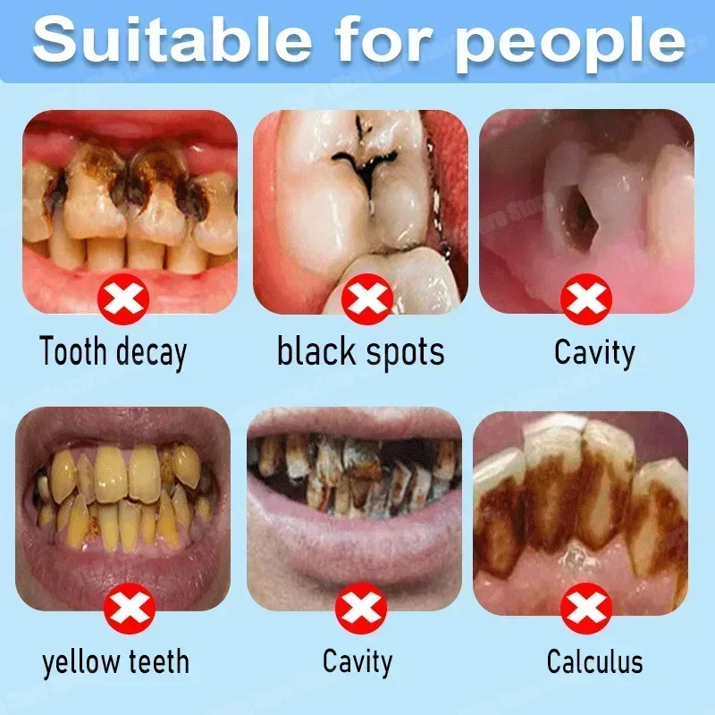 Anti Decay Toothpaste repairs  - Teeth Whitening Gum ulasan dan harga