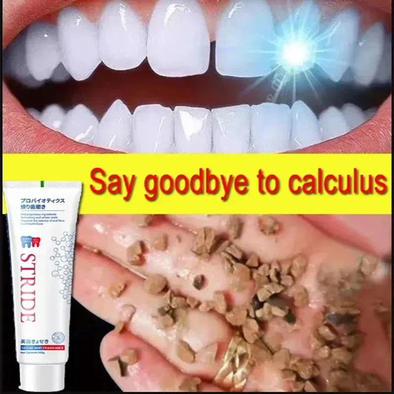 Dental Calculus Remover Remova - Teeth Whitening Treatment ulasan dan harga