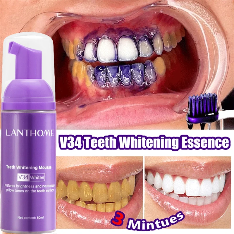 V34 Teeth Whitening Mousse Too - Teeth Whitening/Bleaching ulasan dan harga