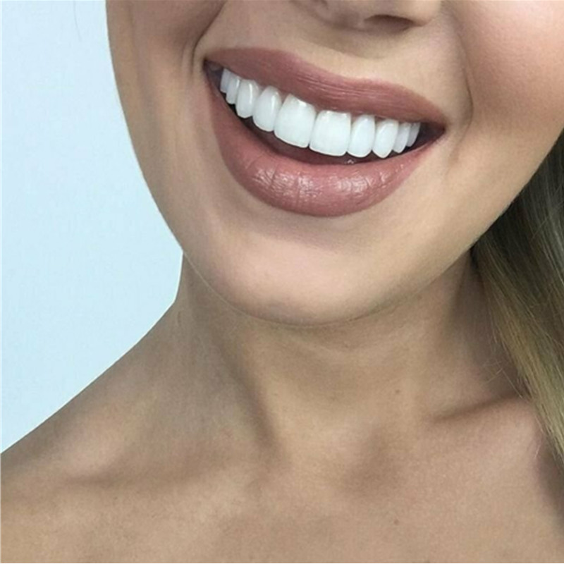 No Staining No Yellowing Teeth - Teeth Whitening Yellow Teeth ulasan dan harga