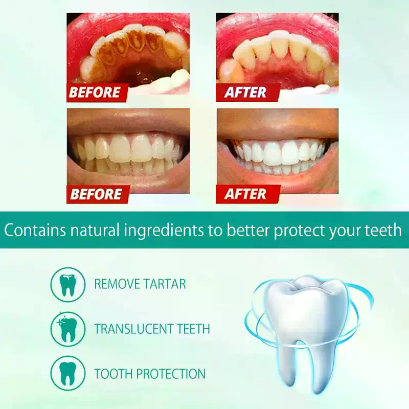 Whitening Foam Toothpaste Clea - Teeth Whitening Foam Toothpaste ulasan dan harga