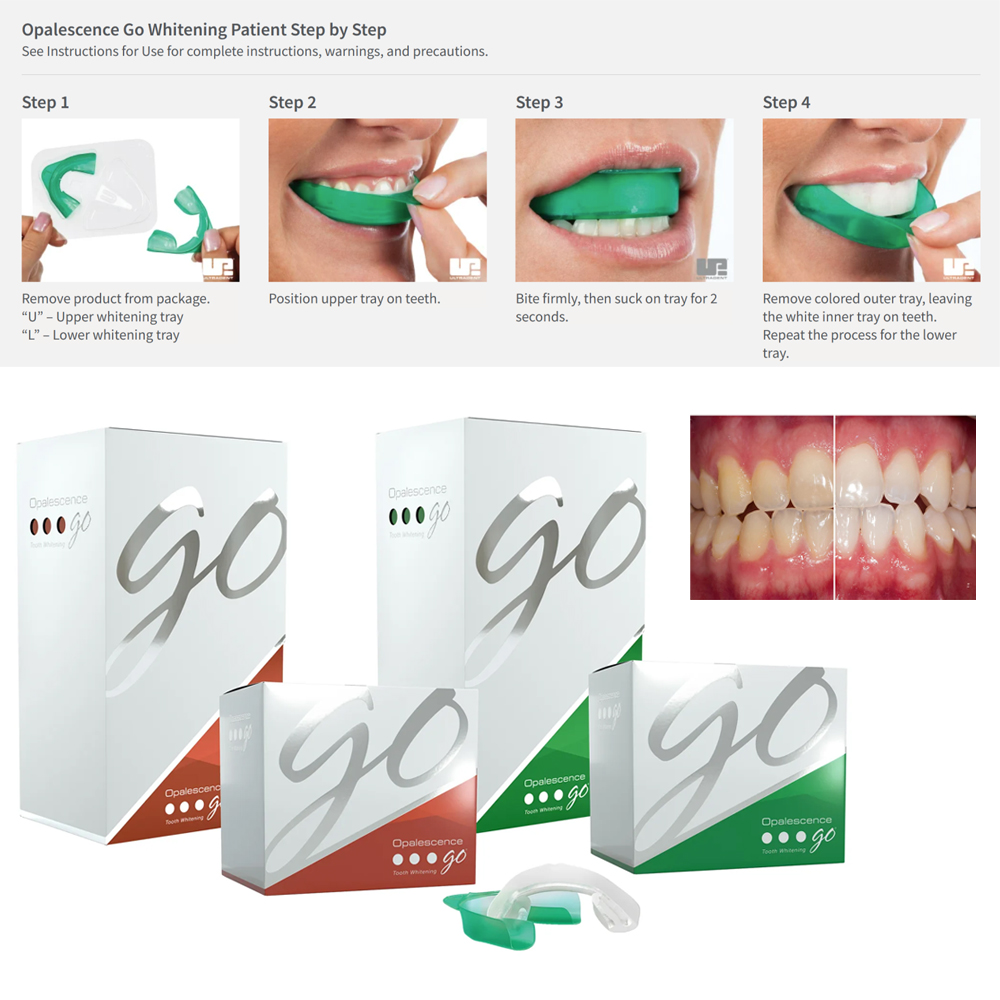 Opalescence Go Teeth Whitening - Teeth Whitening Kit At Home ulasan dan harga