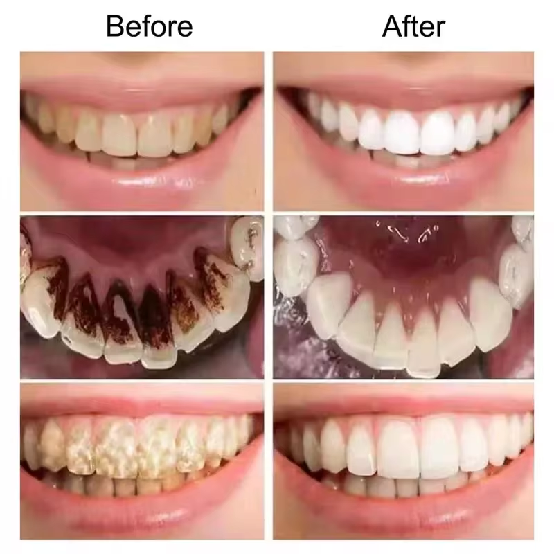 7.5% Hydroxyapatite Probiotic  - Teeth Whitening Treatment ulasan dan harga
