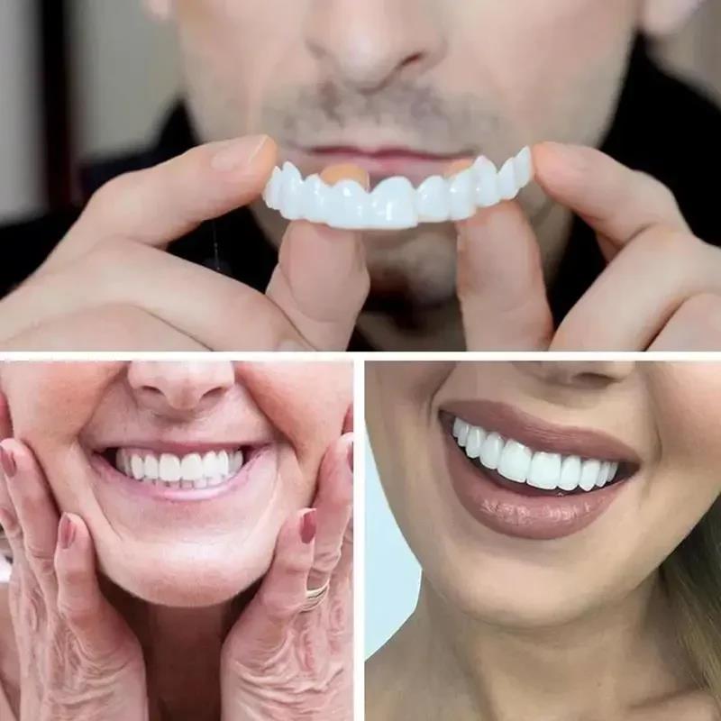 New Charming Smile Teeth Venee - Teeth Whitening Yellow Teeth ulasan dan harga